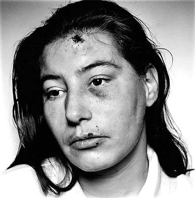 Victim of Domestic Violence in Annie Leibovitz, Women